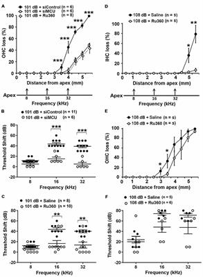 Mitochondrial Calcium Transporters Mediate Sensitivity to Noise-Induced Losses of Hair Cells and Cochlear Synapses